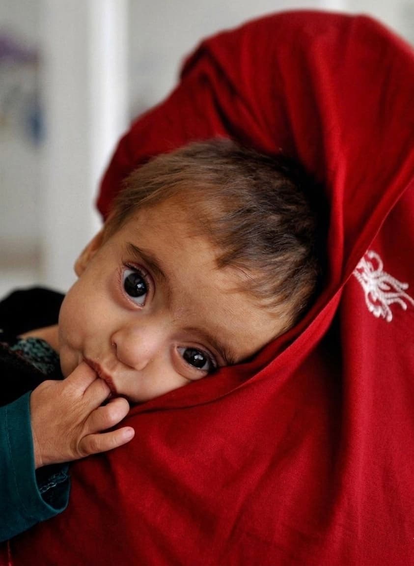 Five million mothers and children in Afghanistan are facing a serious risk of malnutrition.