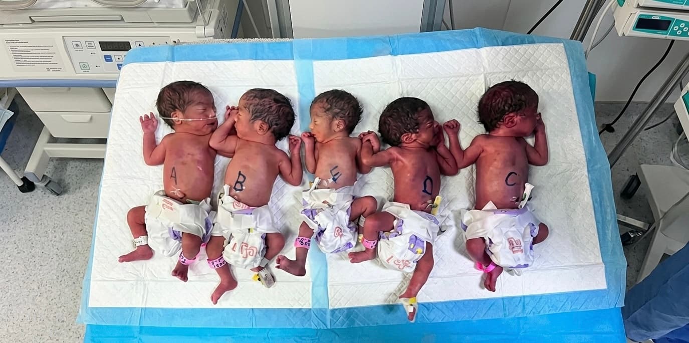 Birth of quintuplets in Balkh: A rare event at Balkh regional hospital.