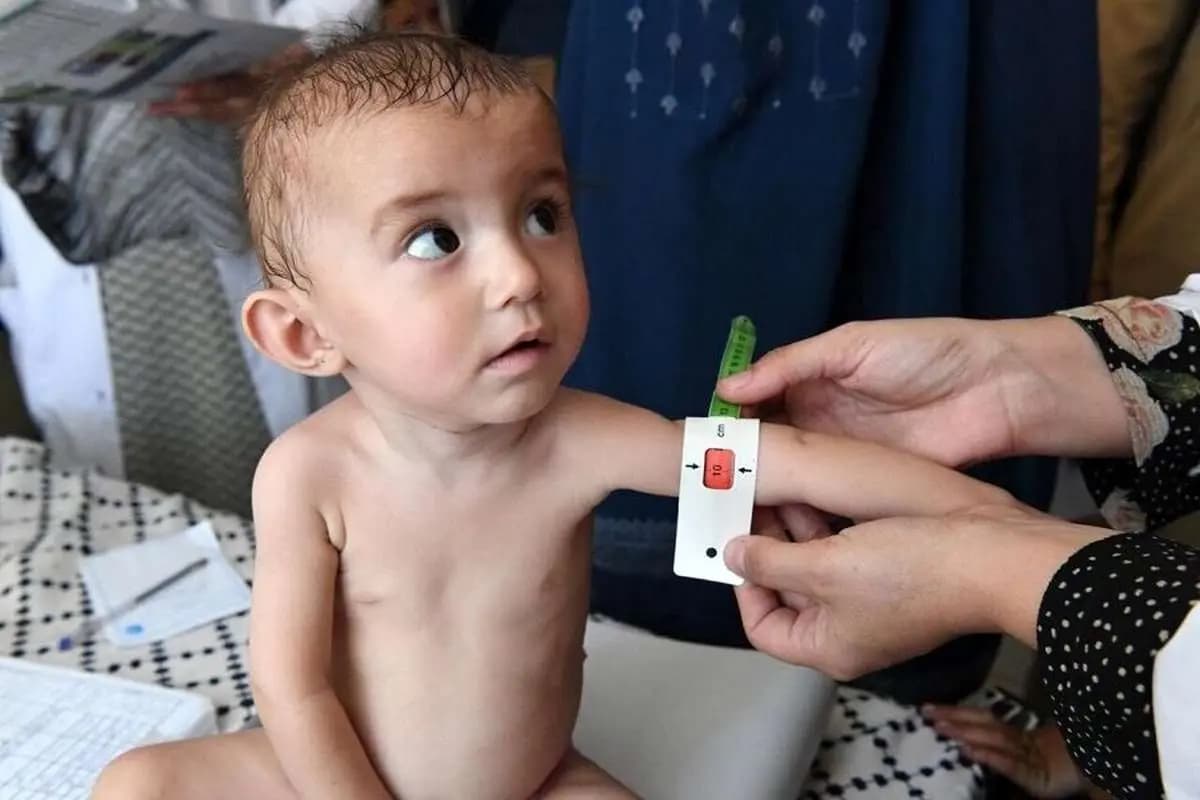 UNICEF: 3.7 Million children in Afghanistan face a serious risk of malnutrition.