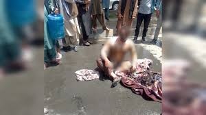 An engineer who had set himself on fire in Kabul due to unemployment has died from his injuries.