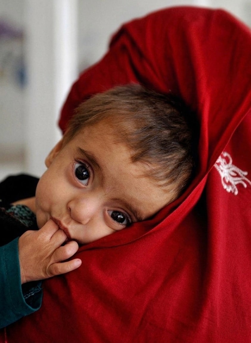 Five million mothers and children in Afghanistan are facing a serious risk of malnutrition.